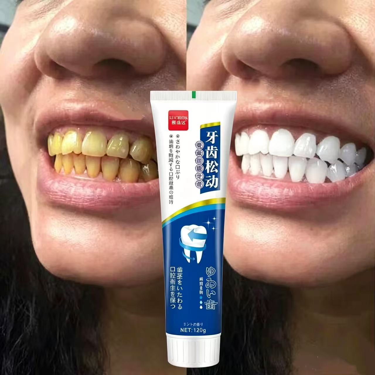 Teeth Whitening Japan - Pasta de Dientes Importada de Japón
