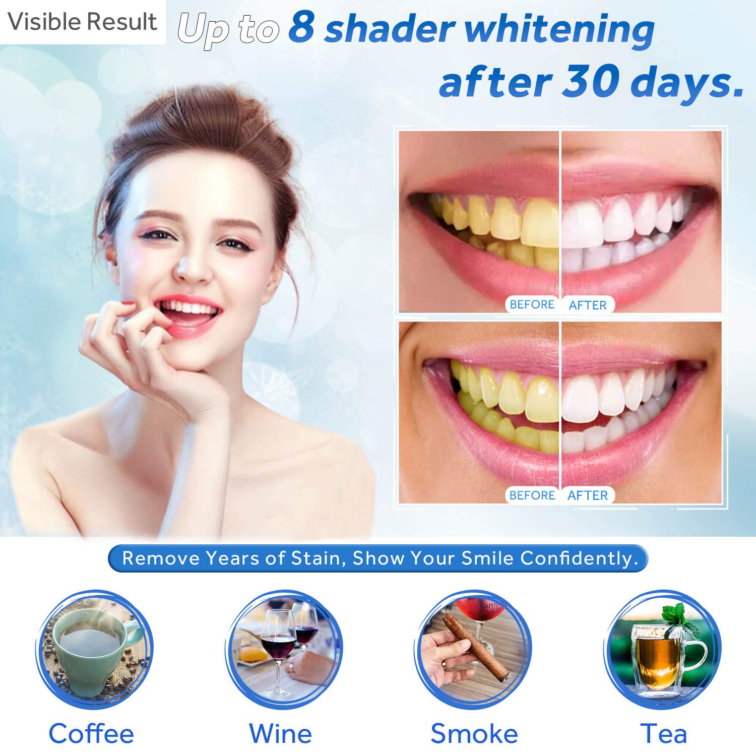 Jeringa de repuesto de Gel par - Teeth Whitening Results reseña y precio