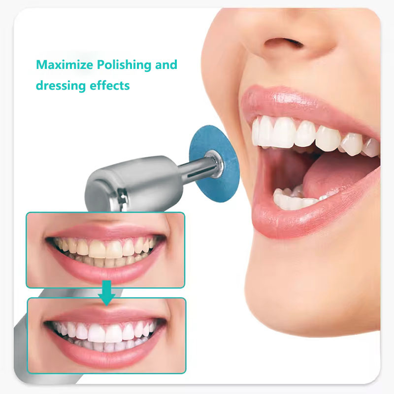 40 Uds. Discos de Pulido Denta - Teeth Whitening Uk reseña y precio