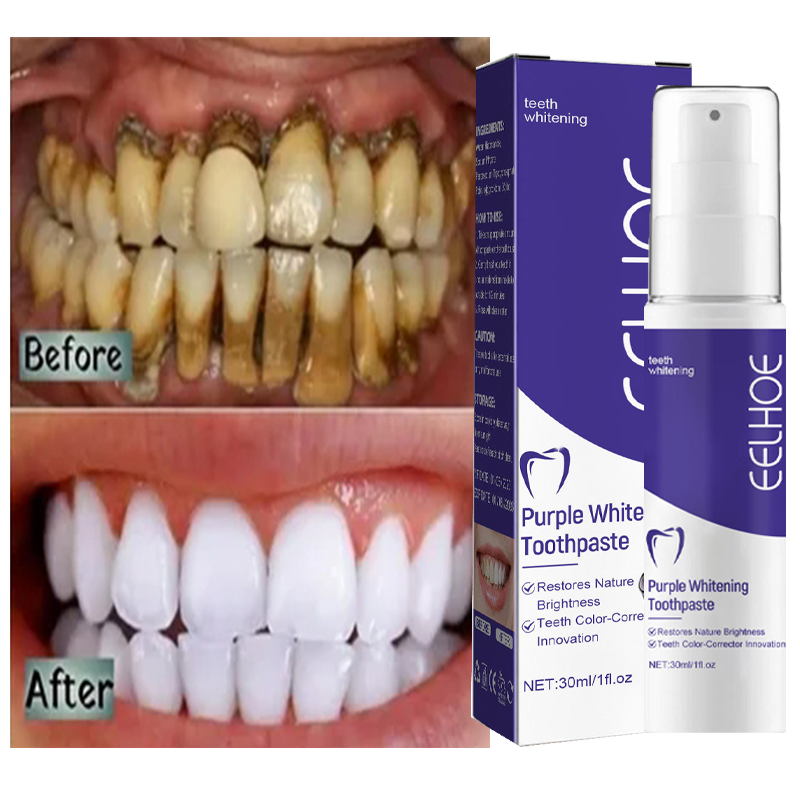 Pasta de dientes piezas limpie - Teeth Whitening Korea reseña y precio