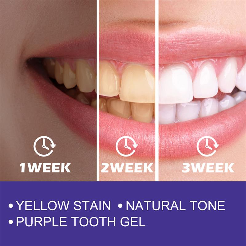 Pasta de dientes piezas limpie - Teeth Whitening Korea reseña y precio