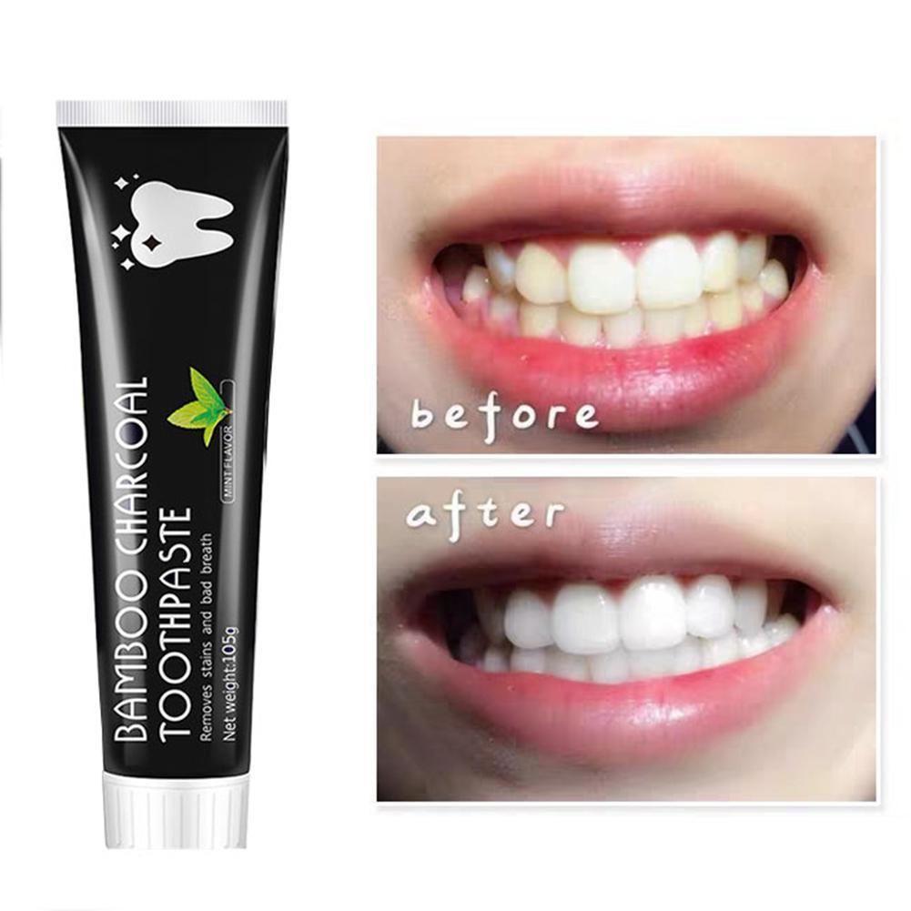 Pasta de dientes de carbón de  - Teeth Whitening Filter reseña y precio